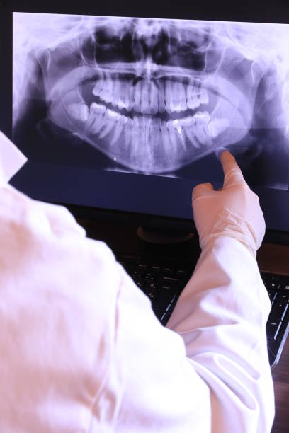 Best Emergency Treatment for Dental Infections or Abscesses in New Berlin, IL
